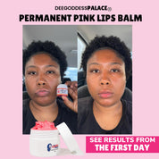 Permanent Pink Lips Balm (100% Effective)