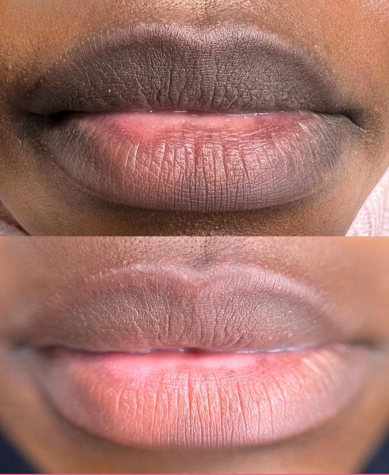 Permanent Pink Lips Balm (100% Effective)